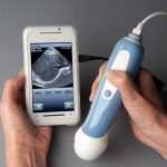 胎児の様子が分かるスマホ用の超音波カメラ